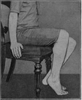 Fig. 108. The final stage in the first sitting exercise. The heels cannot reach the ground