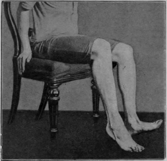 Fig. 109. The first two sitting exercises in the re education of walking combined. The toes are raised and lowered, alternating with similar action of the heels. The result is the species of clog dance referred to in the text