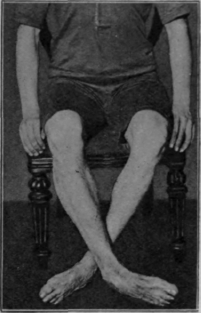 Fig. 110. To illustrate the clawing exercise while sitting