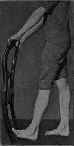 Fig. 115. To show how the patient takes the first quarter of a full step. The left leg has been swung to and fro and is then checked in the position shown