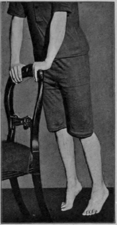 Fig. 119. The second position in tip toe exercises. The weight of the body has been rolled across the transverse metatarsal arch
