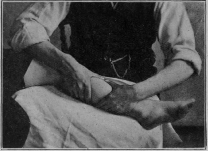Fig. 12. To illustrate picking up of the calf muscles. The flexion of knee combined with plantar flexion of ankle ensures relaxation. Adequate lateral support for the knee is essential in this position. If the masseur stands at the end of the bed, the foot should rest with its plantar surface upon it, the knee being flexed to nearly a right angle (cf. Fig. 15, p. 60)