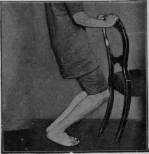 Fig. 122. The first heel raising knee bending exercise. Note the knees fall directly over the toes. The feet are kept parallel