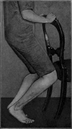 Fig. 123. The second heel raising knee bending exercise. Note the knees still fall directly over the toes. The feet are at about an angle of 90° to one another