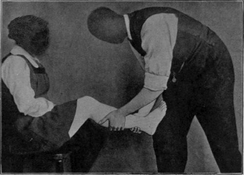 Fig. 125. To show one method of attempting to stretch the tendo Achillis