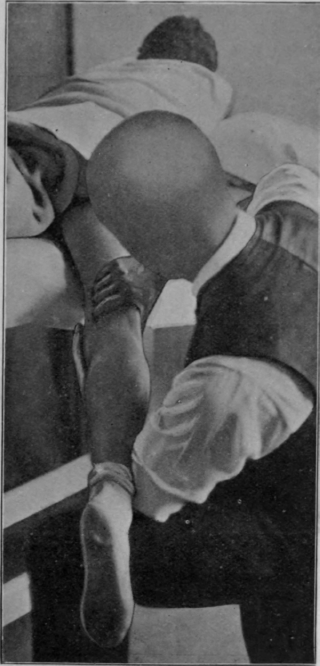 Fig. 146.   The end of the movement shown in Fig. 145