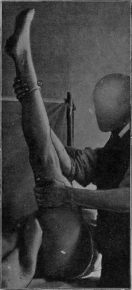Fig. 147.   To show how the foot naturally passes into plantar flexion when the hip joint is flexed, the knee being fully extended. Dorsi flexion of the ankle adds materially to the stretching of all structures on the back of the limb.1