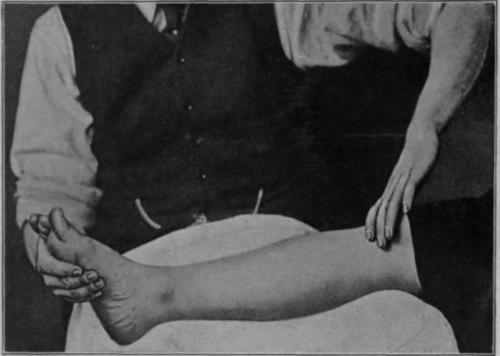 Fig. 7. Showing upward surface stroking of the lower extremity, the finish of the stroke just before contact between hand and skin ceases. Although reference is made to the commencement and the finish of the stroke, it must be clearly understood that the finish represents equally well the commencement of the return of the hand through the air. As the movement is continuous, there can be no beginning or end.