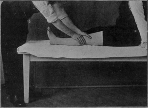 Fig. 8. Upward stroking of the lower extremity to illustrate some common faults in position