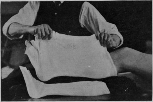Fig. 89 To show how a leg may be raised from a posterior gutter splint by means of a cradle of lint before union is consolidated