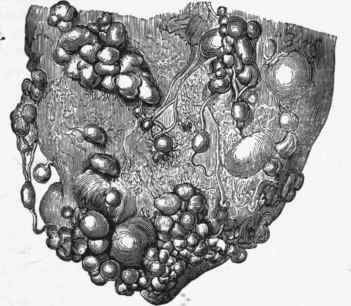A piece of lung in bovine tuberculosis.