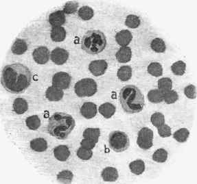 Blood corpuscles, stained with logwood and eosine.