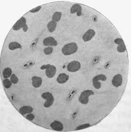 Capsule coccus from exudation in case of lepto meningitis.