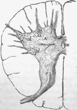 Progressive muscular atrophy section of cord in cervical region, from an advanced case.