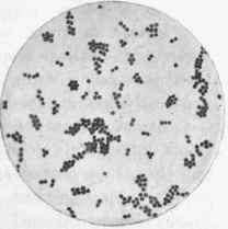 Staphylococcus pyogenes aureus, x about 1000.
