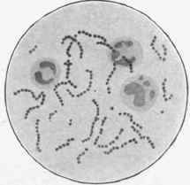 Streptococcus pyogenes, x about 1000.