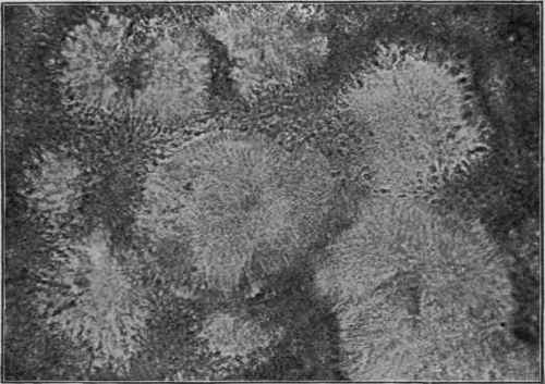 Actinomyces of Madura Foot (Wright and Brown).