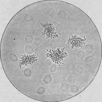 Agglutination of the Typhoid Bacillus by a Specific Serum.