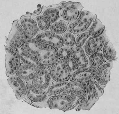 Alveolar Adenoma of the Mammary Gland. Oc. 2; ob. 9 (McFarland).