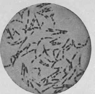 Bacillus Diph therle, Same Culture, Fifteen Hours at 360 C.