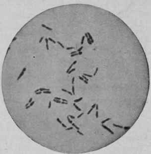 Bacillus DiphtheriAe, Same Culture, Eight Hours at 360 C.