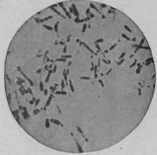 Bacillus Diphtheria, Same Culture as Figs. 87 90, Twenty four Hours at 36° C.