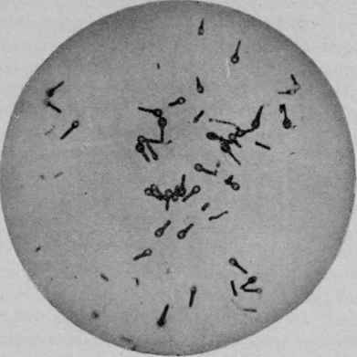 Bacillus of Tetanus with Spores (Fränkel and Pfeiffer).