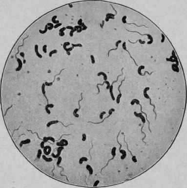 Cholera Spirilla, showing Flagella (Muir and Ritchie).
