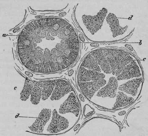 Cloudy Swelling of the Kidney Epithelium. X800 (Ziegler).