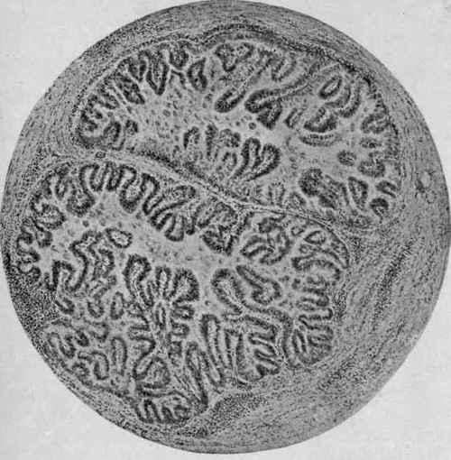 Coccidiosis of Rabbit's Liver (McFarland).