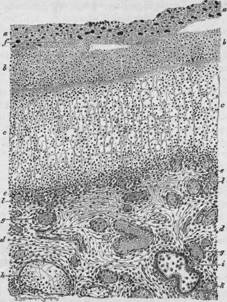 Diphtheric Membrane from the Uvula. X 50 (Ziegler).