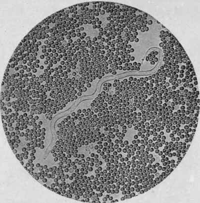 Embryo of Filaria Bancrofti. Microfilaria Bancrofti. Living specimen.