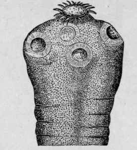 Head of Taenia Solium (Mosler and Peiper).