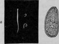 Oxyuris Ver micularis and Egg (after Heller).