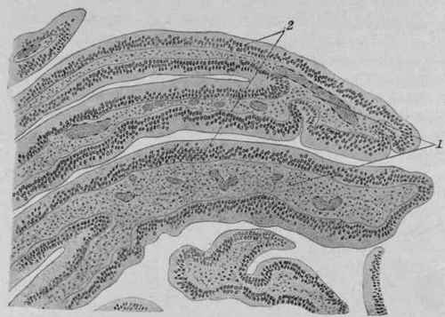 Papillary Adenoma from the Rectum. Hemat. eosin.