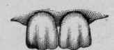Serrations in Normal Teeth (Cornil and Ranvier).