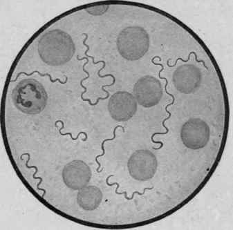 Spirilla of Relapsing Fever in Human Blood. X 1000 (Boston).