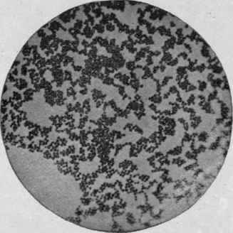 Staphylococcus Pyogenes Aureus, from an Agar agar Culture. X 1000 (Günther).