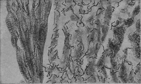 Syphilis, Congenital. Heart (Mallory). Treponemata pallida in connective tissue and between muscle fibers.