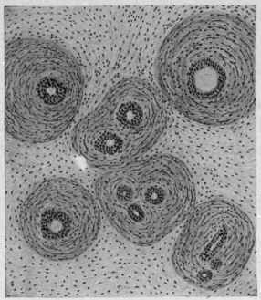 Tumors 180