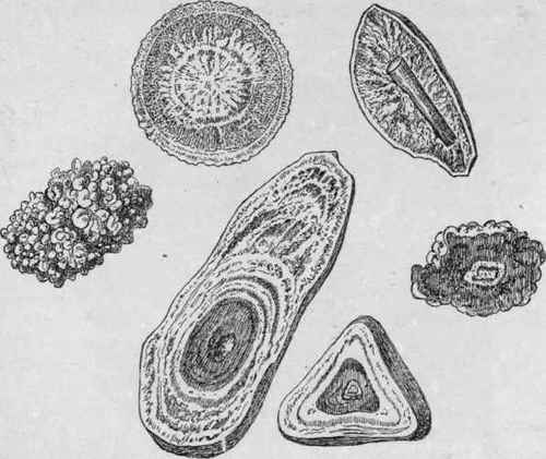 Urinary Calculi (Orth).