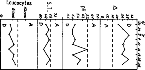 offbalance type D, shows high urine specific gravity