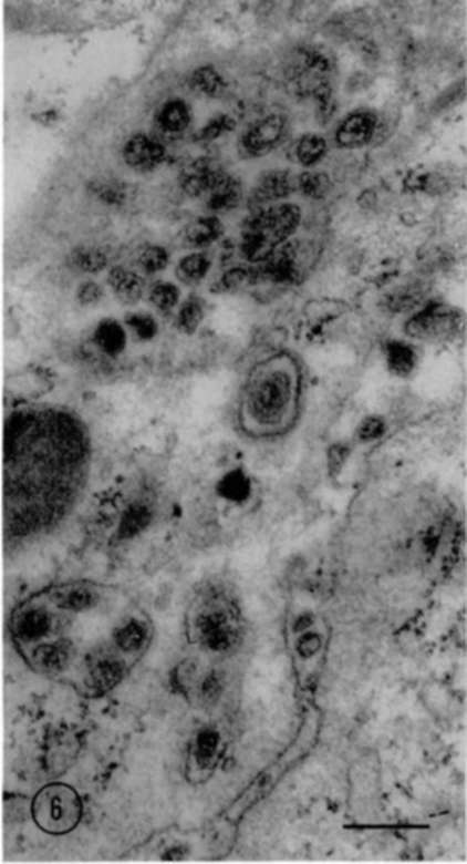 Electron micrograph of part of cell in mouse leukemic lymph node