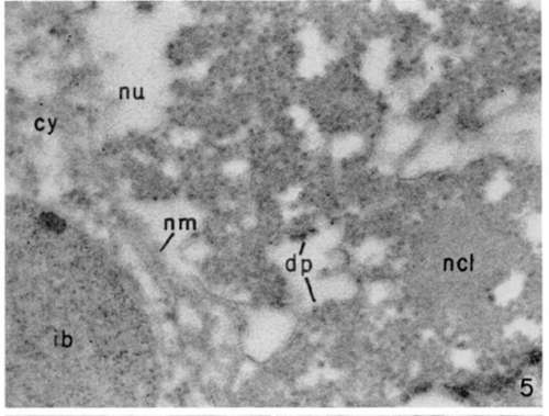 Portion of leukemia tumor cell