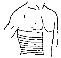 Fig. 371. Broad Bandage for Fracture of the Ribs.