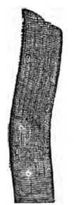 Fig. 334. Healthy Muscular Fibres.
