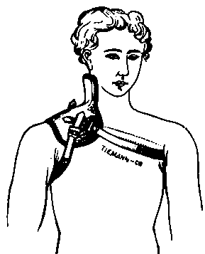 Fig, 321. Splint for Wry Neck.