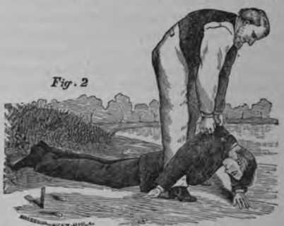 Fig. 382. Treatment of the Drowned Part 2.