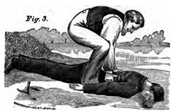 Fig. 383. Treatment of the Drowned Part 3.
