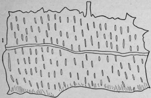 Pitted Vessels With Bordered Pores HistologyOfMedicinalPlants 120
